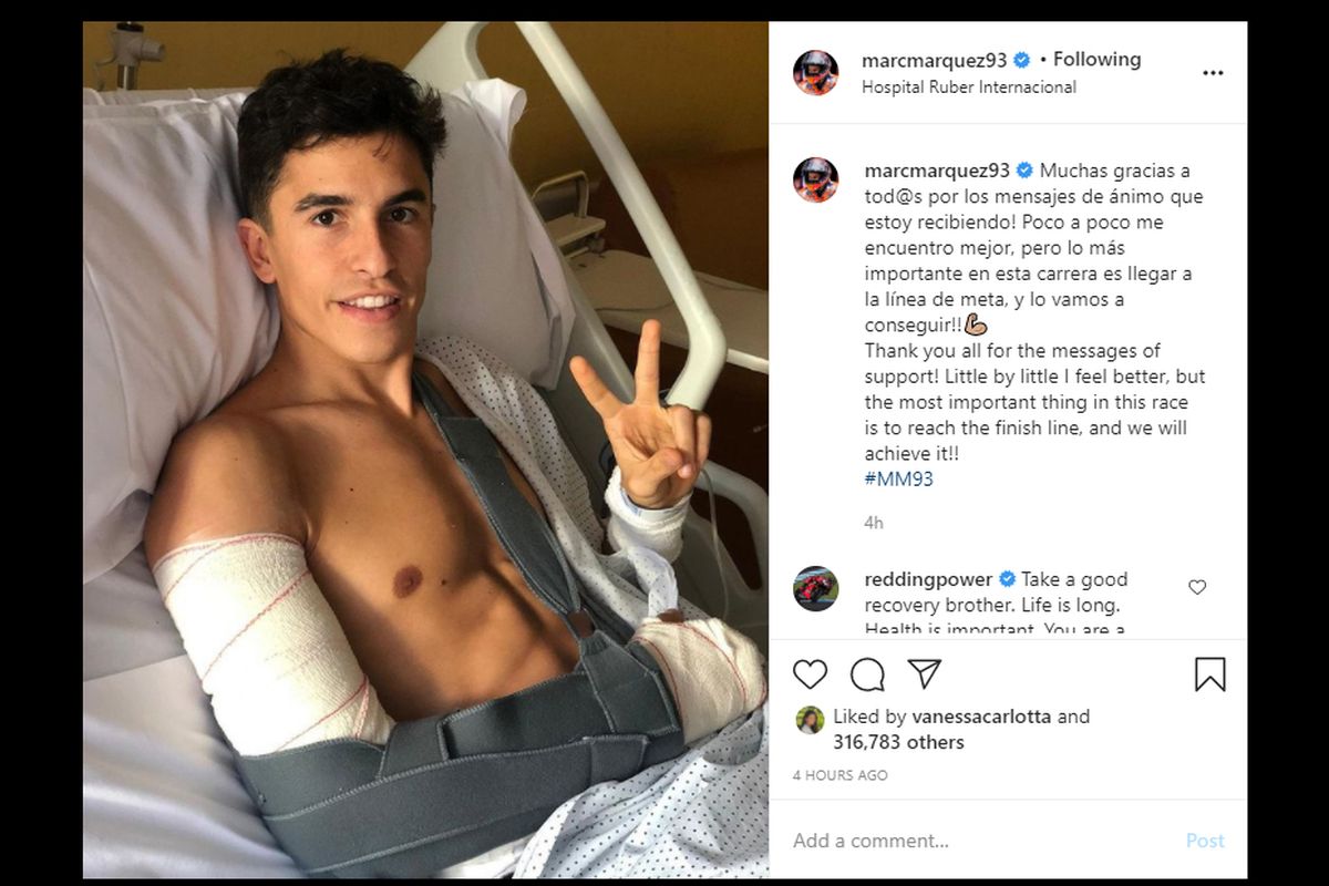 Kondisi Marc Marquez pasca operasi ketiganya