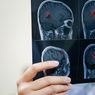 12 Cara Mencegah Penyakit Otak yang Membahayakan