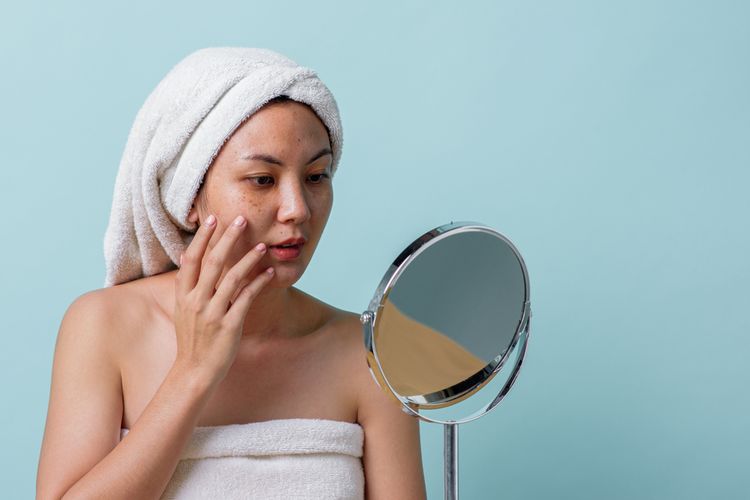 Melakukan perawatan medis adalah salah satu cara mengatasi kulit belang di wajah.