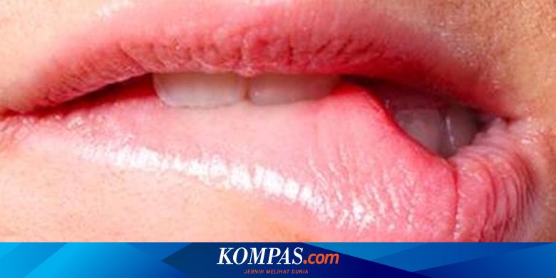 5 Bahan Alami untuk Mengatasi Sariawan