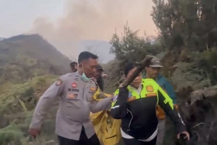 Kondisi 1 Korban Karhutla Bromo yang Dirawat di RSUD Soetomo, Masih Pakai Alat Bantu Napas