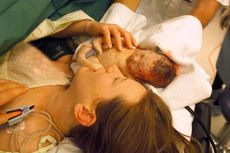 Bayi Lahir Prematur: Penyebab dan Cara Mencegahnya