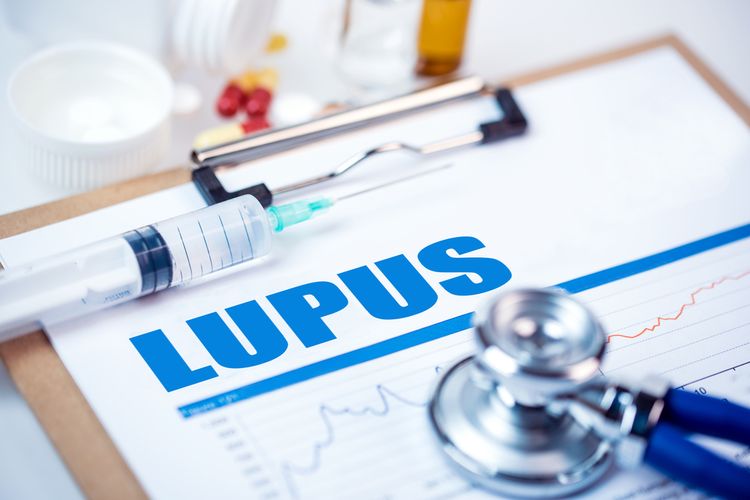 7 Gejala Lupus yang Perlu Diwaspadai: Ada Kaku Sendi dan Ruam Kulit