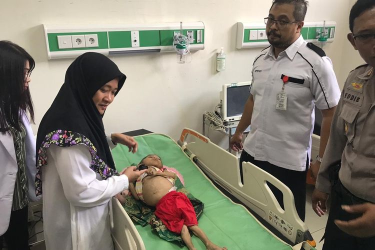 Balita Ahmad Fajar, saat diperiksa tim medis di RSUD RA Basuni Mojokerto, Rabu (10/4/2019).
