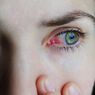 10 Cara Mengatasi Mata Gatal dan Merah, Termasuk Pakai Obat Tetes Mata