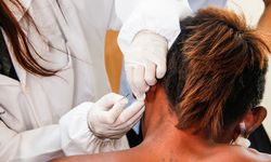 Bercak Putih Mati Rasa Bisa Jadi Gejala Kusta, Ini Penjelasan Dokter