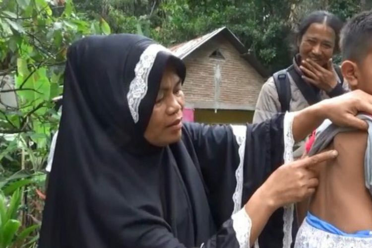 Salah seorang bocah di Desa Jonjo, Kecamatan Parigi, Kabupaten Gowa, Sulawesi Selatan menjadi korban serangan anjing gila. Kamis, (21/2/2019).