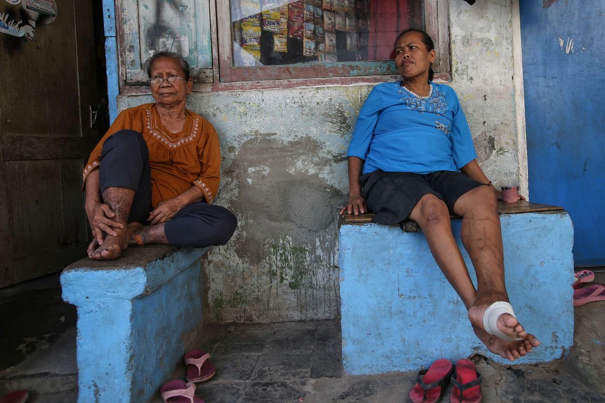 Eks penderita kusta di Kampung Sitanala, Kelurahan Karangsari, Kecamatan Neglasari, Kota Tangerang, Banten, Selasa (20/8/2019). Di kampung yang berada di belakang RS dr. Sitanala ini dihuni sekitar 1000 eks penderita kusta dan keluarganya.