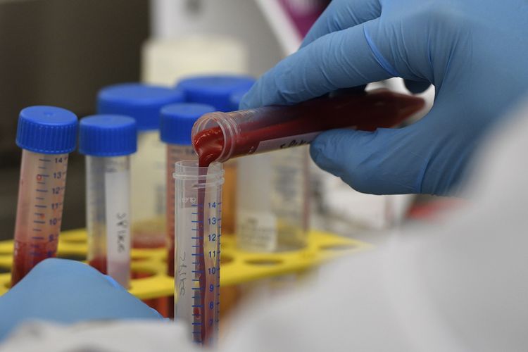 Peneliti di INTA (National Agricultural Technology Institute) dan CONICET (National Scientific and Technical Research Council) Argentina memperlihatkan pemurnian limfosit dan sampel darah untuk pembuatan vaksin Covid-19. Gambar diambil pada 2 Juni 2020.