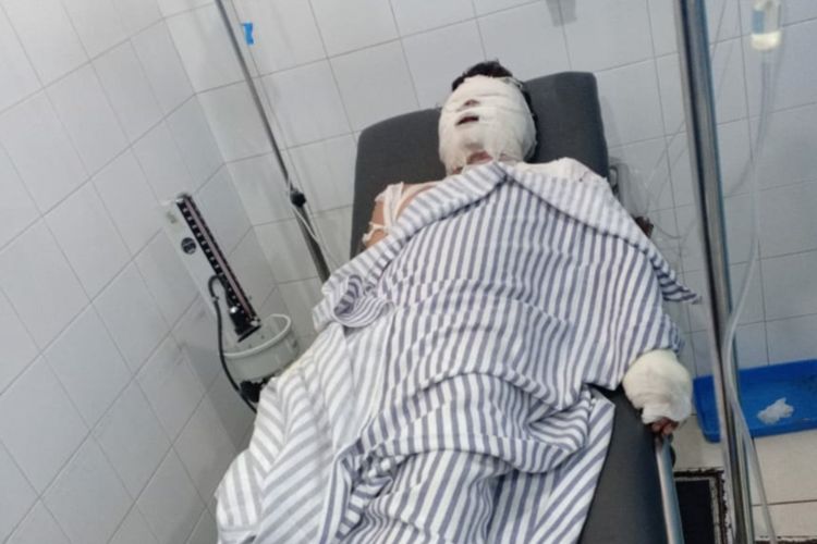 Luki Ludiana (26), terbaring di rumah sakit setelah menderita luka bakar akibat dikeroyok komplotan perampok, Rabu (8/1/2020).