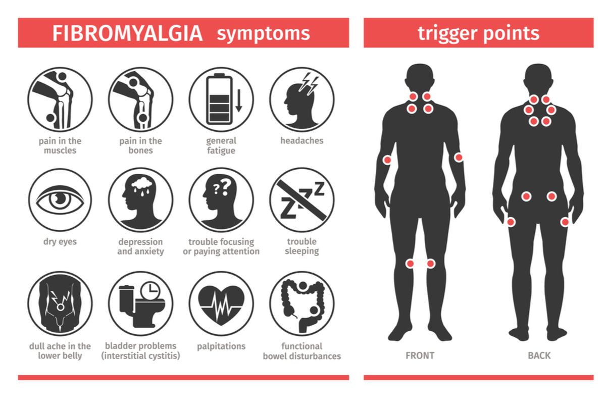 ilustrasi Fibromyalgia