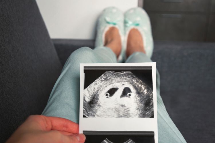 Ilustrasi hamil kembar.