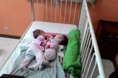 Bayi Kembar Siam di RS Harapan Kita Akan Segera Dioperasi