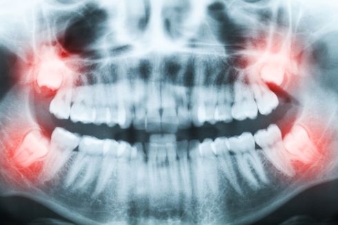 7 Organ Vestisial Manusia yang Tidak Dibutuhkan Tubuh, Apa Saja?