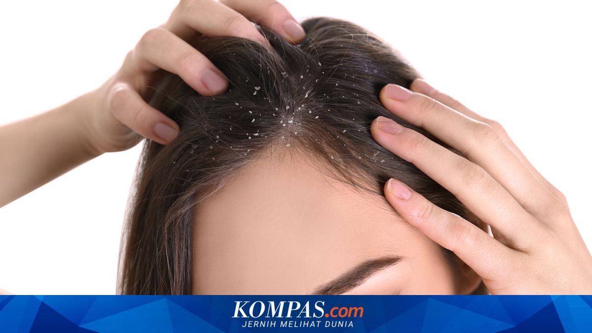 Mengenal Penyebab Scalp Psoriasis dan Apa Bedanya dengan Ketombe? Ini ...