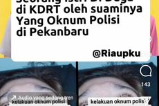 Foto Viral Curhatan Istri Polisi Dianiaya Suaminya di Pekanbaru