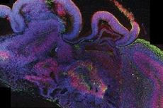 Ilmuwan Berhasil Membuat Otak Mini dari Sel Punca