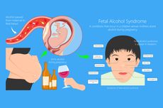 Fetal Alcohol Syndrome (FAS) atau Sindrom Alkohol Janin