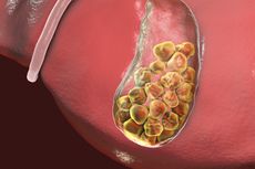 2 Jenis Operasi Batu Empedu yang Perlu Anda Ketahui