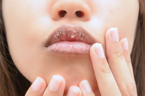 Ramai soal Bibir Dipegang Disebut seperti Plastik, Ini Kata Dokter
