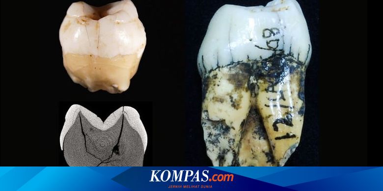 Manusia Pertama Penghuni Indonesia Diungkap Gigi Ini Jejaknya Halaman All Kompas Com
