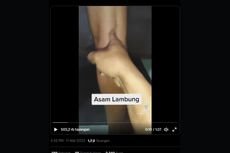 Viral, Video Sentil Lutut Belakang Diklaim Cara Mengecek Asam Lambung, Ini Kata Dokter 