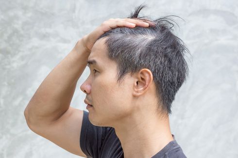 Tekanan Stres Bikin Rambut Beruban, Benarkah?