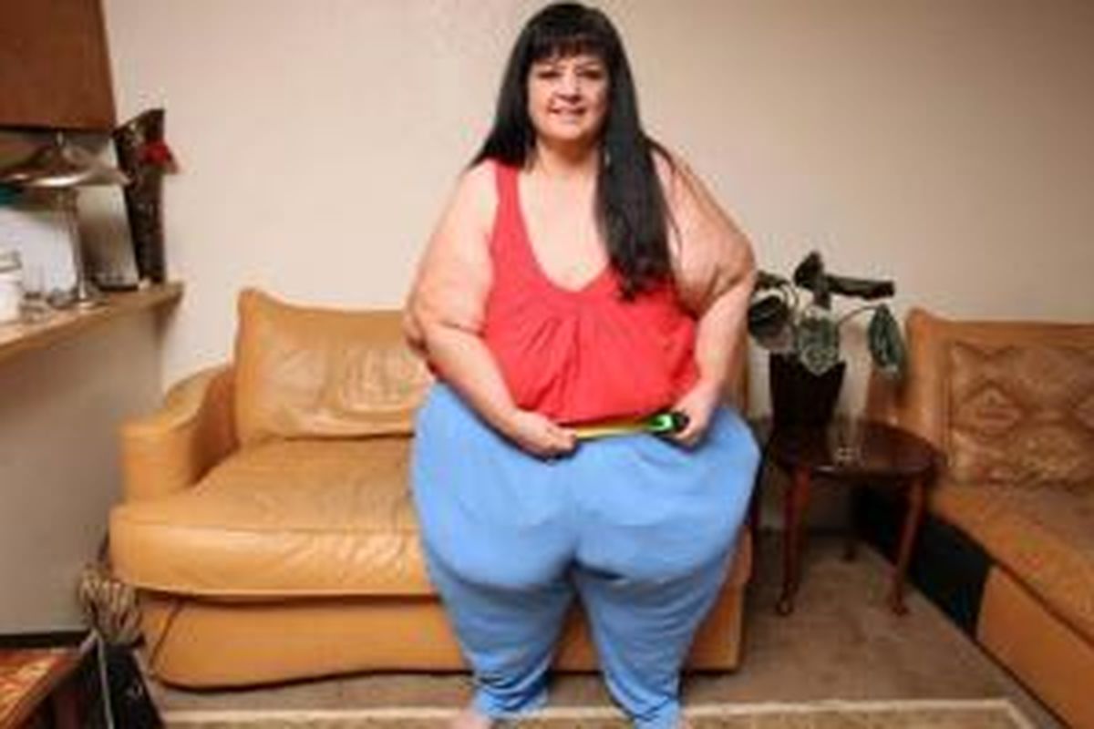 Sanchez berhasil menurunkan berat badan 100 kilogram setelah memutuskan pasangan yang membuatnya obesitas.