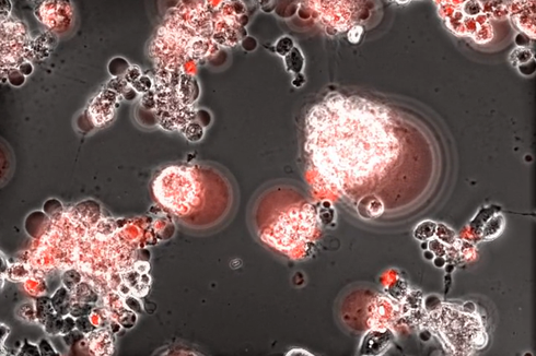 [Video] Detik-detik Virus Corona Menyerang Sel Otak