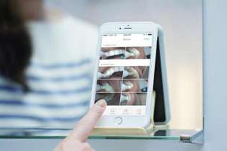 Pengguna dapat melihat hasil jepretan atau pun rekaman video dari dalam rongga mulut mereka dengan menggunakan smartphone.  