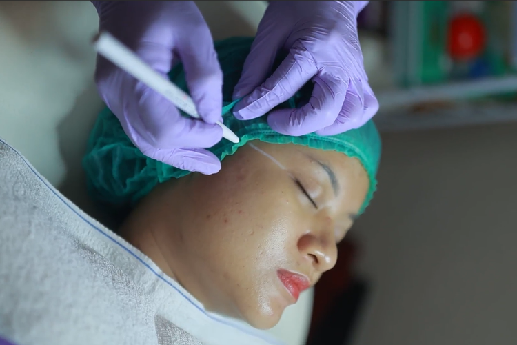 Perawatan Anti-Penuaan Collagen Stimulator, Jangan Lakukan 4 Hal Ini