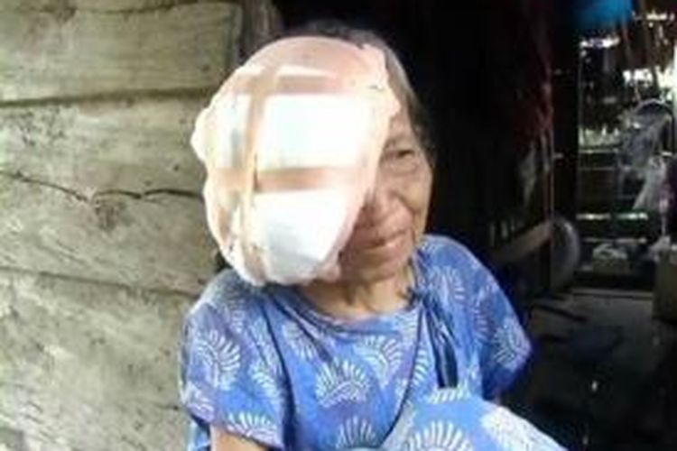 Kepala nenek Cicci Pondi (70) separuh telah jadi santapan belatung. Miskin sarana kesehatan di desanya yang terpencil membuat penyakit nenek ini tak tertangani petugas kesehatan dengan baik. 