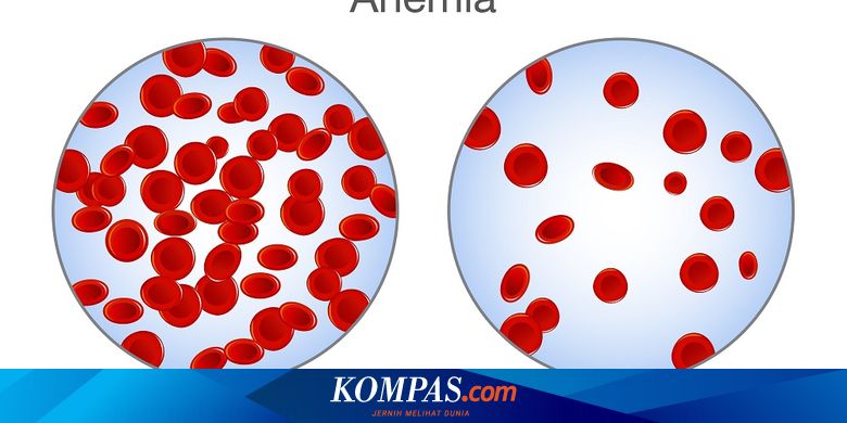 Penyakit anemia dapat terjadi disaat tubuh tidak dapat menghasilkan