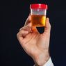 Faktor yang Memengaruhi Proses Pembentukan Urine