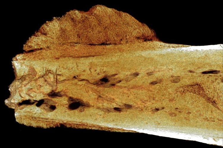 Foto Micro-CT yang menunjukkan adanya osteosarcoma pada fosil berusia 1,7 juta tahun.