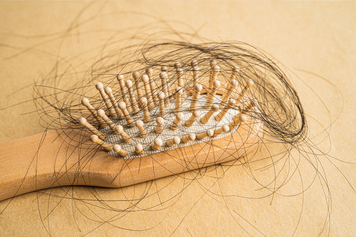 ilustrasi rambut rontok.