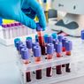 Sedang Dikembangkan, Tes Darah untuk Deteksi 50 Jenis Kanker