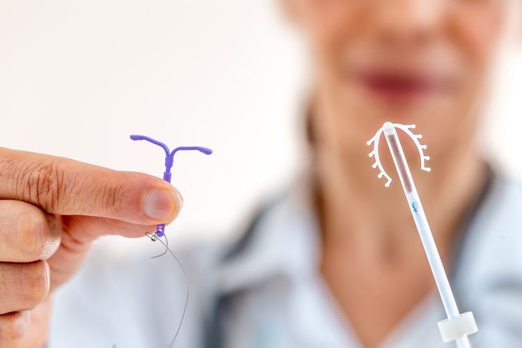  Alat kontrasepsi rahim atau Intraurine device (IUD) yang digunakan sebagian wanita, dapat bergeser dan keluar dari area pemasangannya. 