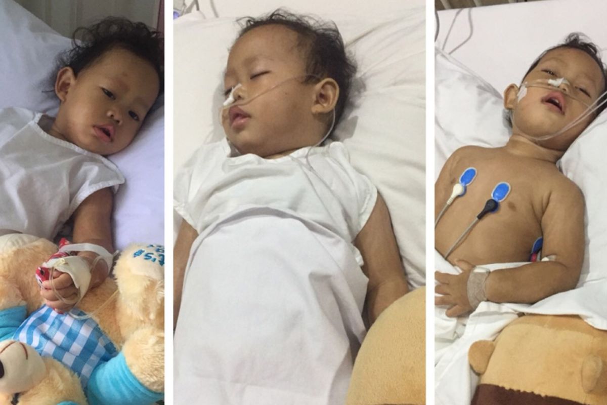 Kondisi bayi Iffah yang dirawat karena infeksi meningitis.