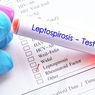 19 Kasus Leptospirosis Ditemukan di Kota Yogyakarta, 6 Pasien Meninggal Dunia
