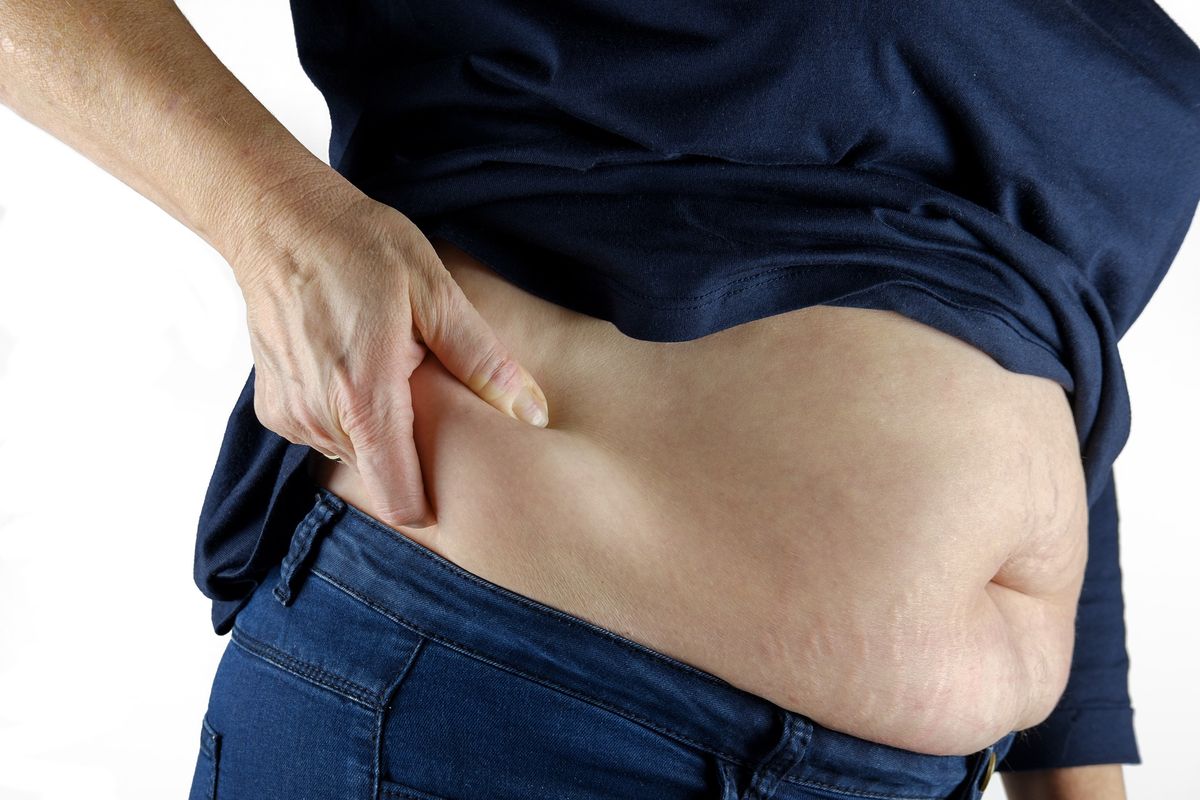 Ada banyak penyebab perut buncit, termasuk pola makan buruk, kurang gerak dan olahraga, dan stres. Melakukan perubahan gaya hidup, termasuk pola makan, dapat membantu menghilangkan lemak perut dan tampilan perut buncit.