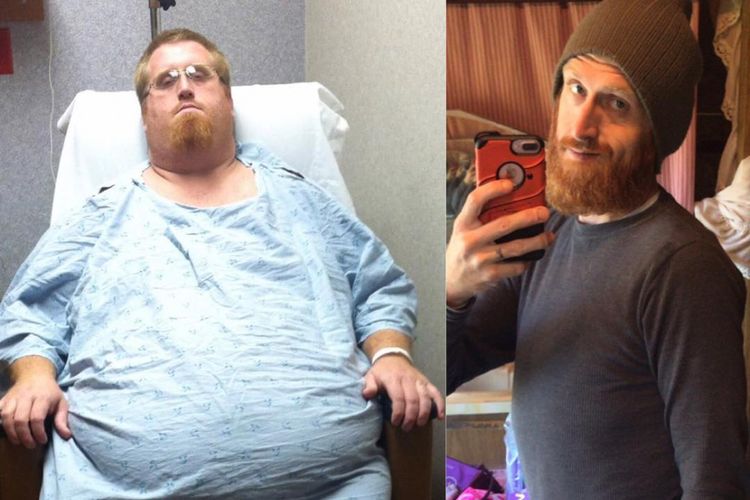 Transformasi berat badan Zach Moore.