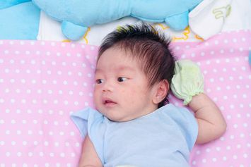Kulit Bayi Beruntusan, Ketahui Penyebab dan Cara Mengatasinya