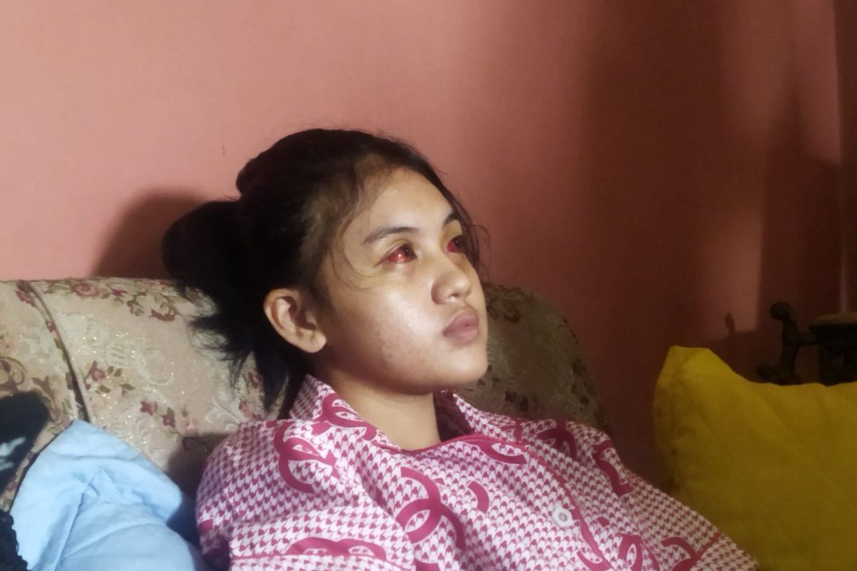 Cahayu Nur Dewata (16) menjadi salah satu korban dari tragedi di Stadion Kanjuruhan pada Sabtu (1/10/2022).