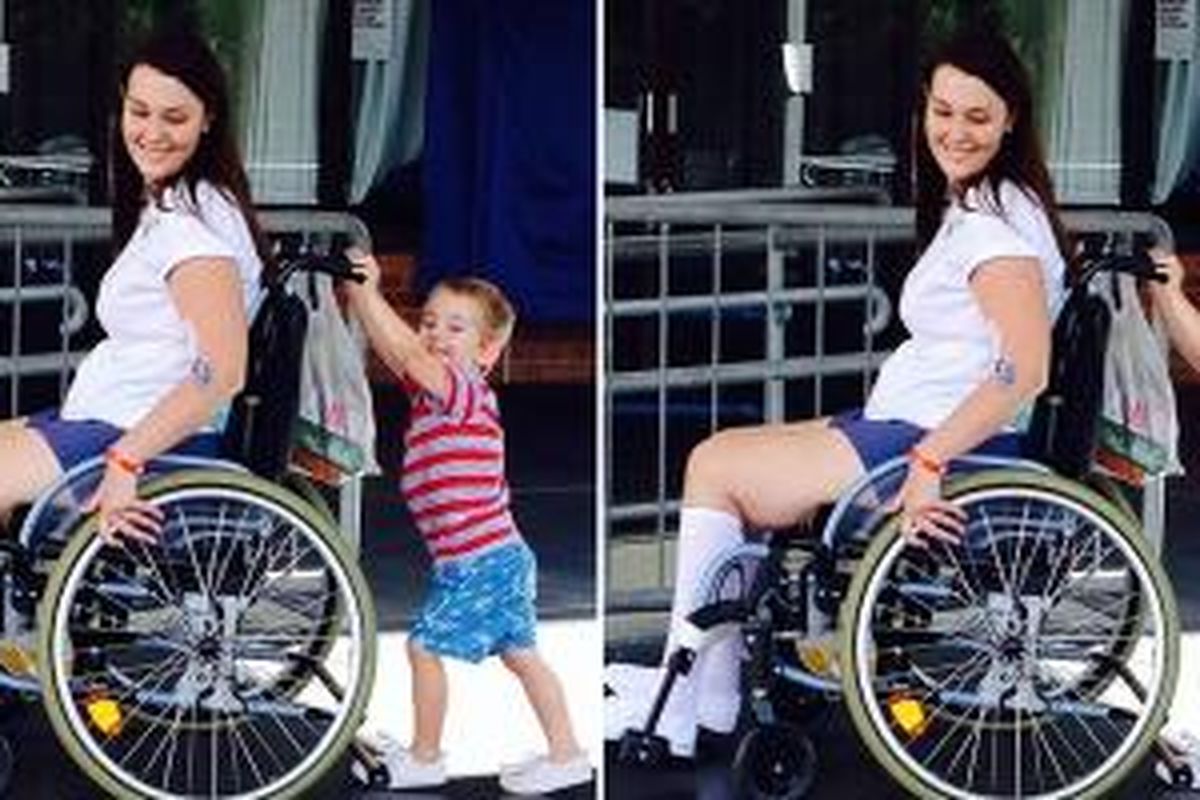 Jo Gilchrist (27) harus menderita cacat seumur hidup dan duduk di atas kursi roda. Kondisi yang dialami Gilchrist ini terjadi setelah dia meminjam alat tata rias milik temannya. 