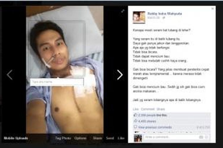 Laman Facebook Robby Indra Wawhyuda yang menderita kanker laring karena merokok sejak kecil.