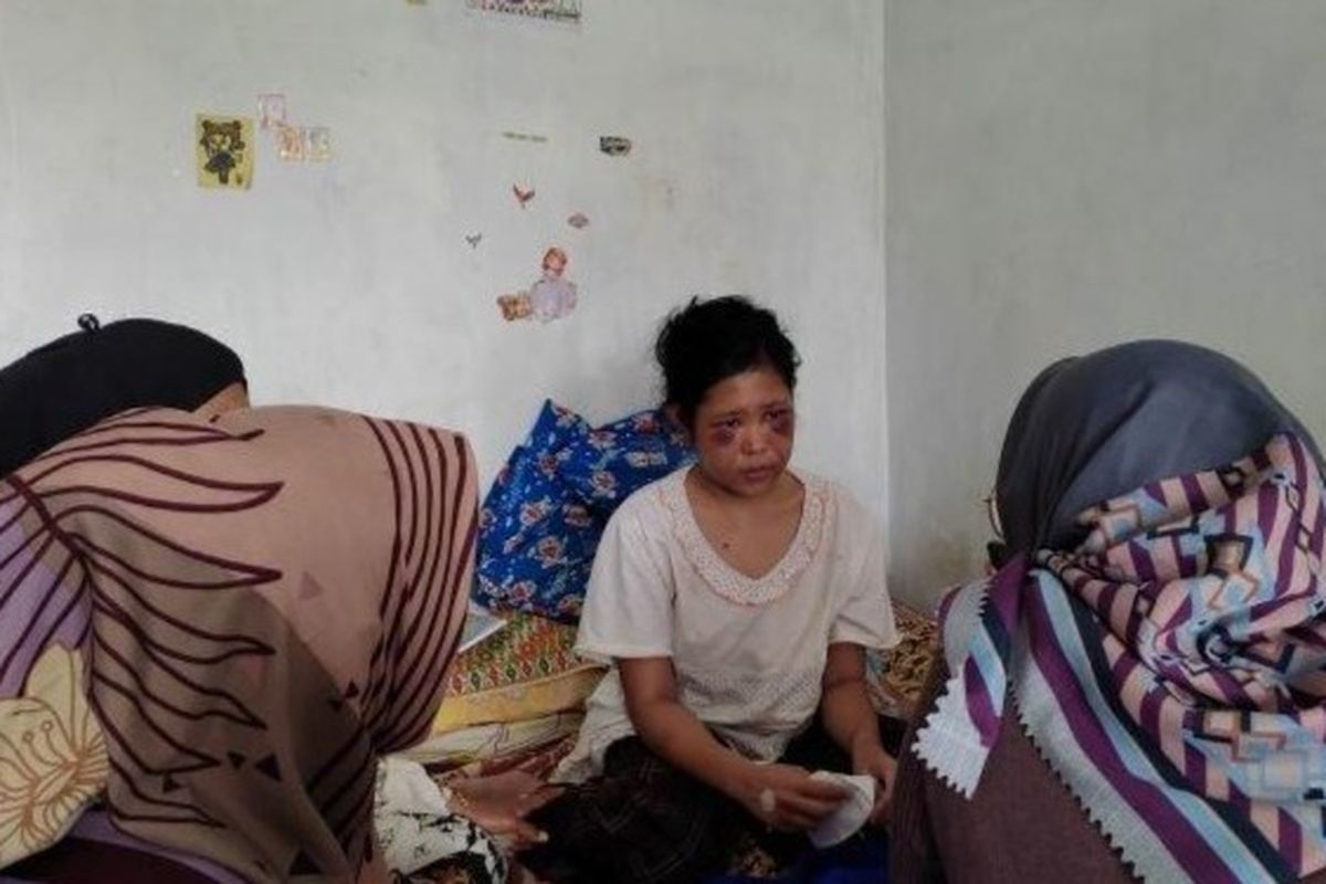Kondisi terkini Rohimah, ART asal Garut yang disiksa majikannya di Kabupaten Bandung Barat. 