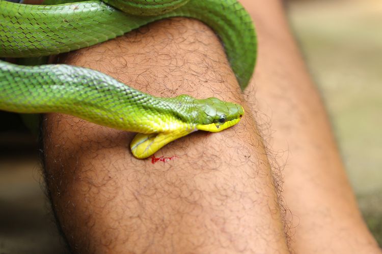 Apa yang terjadi jika kita digigit ular?