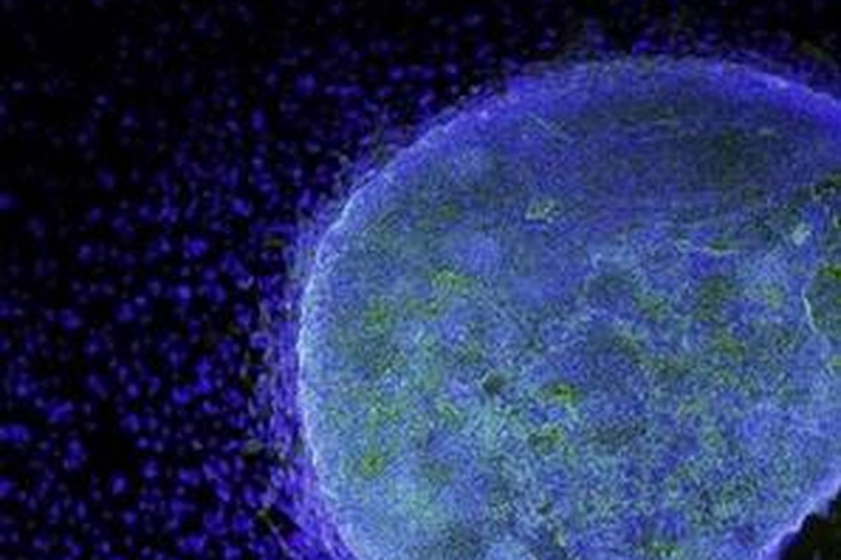 Foto mikroskopis kumpulan sel punca embrionik manusia (biru muda) tumbuh di fibroblast (biru tua).