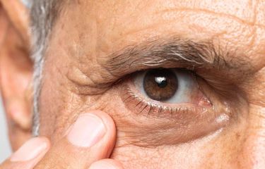 Ilustrasi faktor risiko retinopati diabetik.